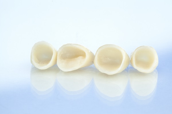 Reasons To Consider A Porcelain Dental Crown