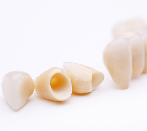 Killeen Dental Crowns and Dental Bridges