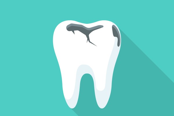 How Dental Restoration Can Help Against Tooth Decay