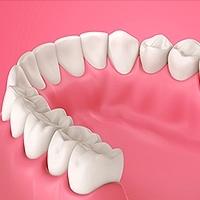 Gum Disease Killeen, TX