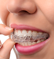 Clear Aligners - Almost Invisible Braces Killeen, TX