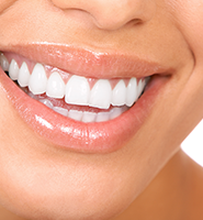 Teeth Whitening Services Killeen, TX